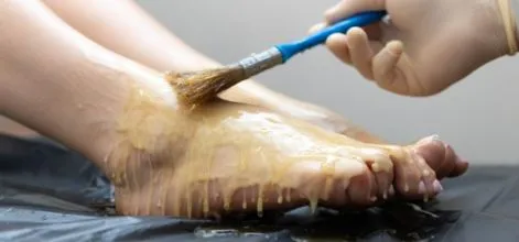 Санаторий Шихово  — лечение грязью и парафином